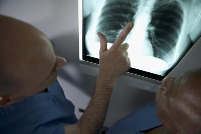 Radiographie pulmonaire