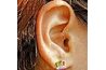 Parlez à votre médecin au sujet de l'oreille agrafage acupuncture pour perdre du poids.