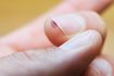 Comment se débarrasser des verrues vulgaires sous les ongles