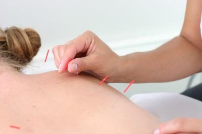 Acupuncture stimule le bon fonctionnement des reins.