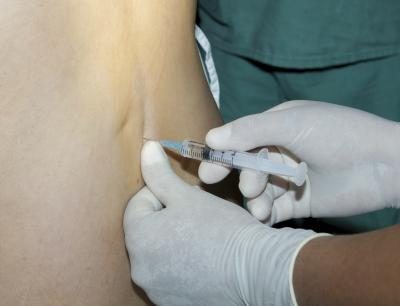 Préparez-vous à épidurale de stéroïdes Les injections de Back & amp; Leg Pain.