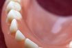 Les prothèses dentaires peuvent activer le réflexe nauséeux en touchant le palais.