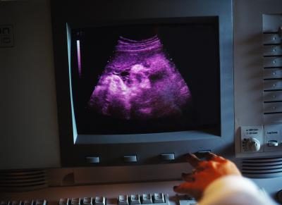 Technicien ultrasons pointant à l'écran