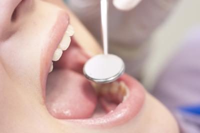 Dentiste regarder dans la bouche des patients