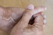 Comment soulager la douleur de nerf dans un petit doigt