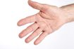 Chacune de vos doigts a deux tendons fléchisseurs. Votre pouce a un tendon fléchisseur.