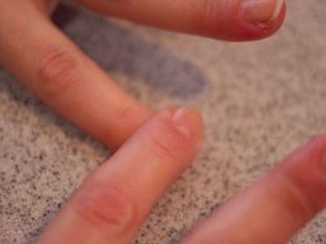 Comment renforcer les ongles