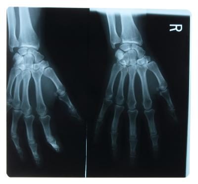 X-ray de la main humaine