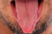 Comment utiliser du sel pour la guérison Tongue Blanc